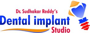 Dental Implant Studio